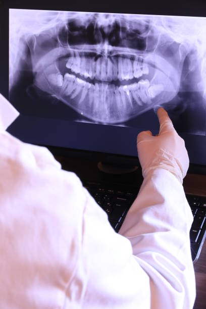 Best Emergency Tooth Extraction in Lynnville, IN